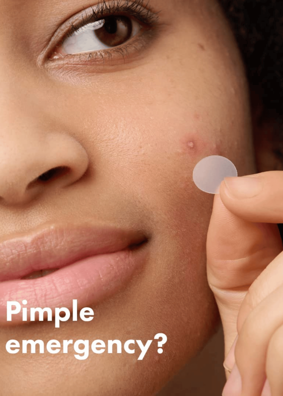Best Pimple Patch